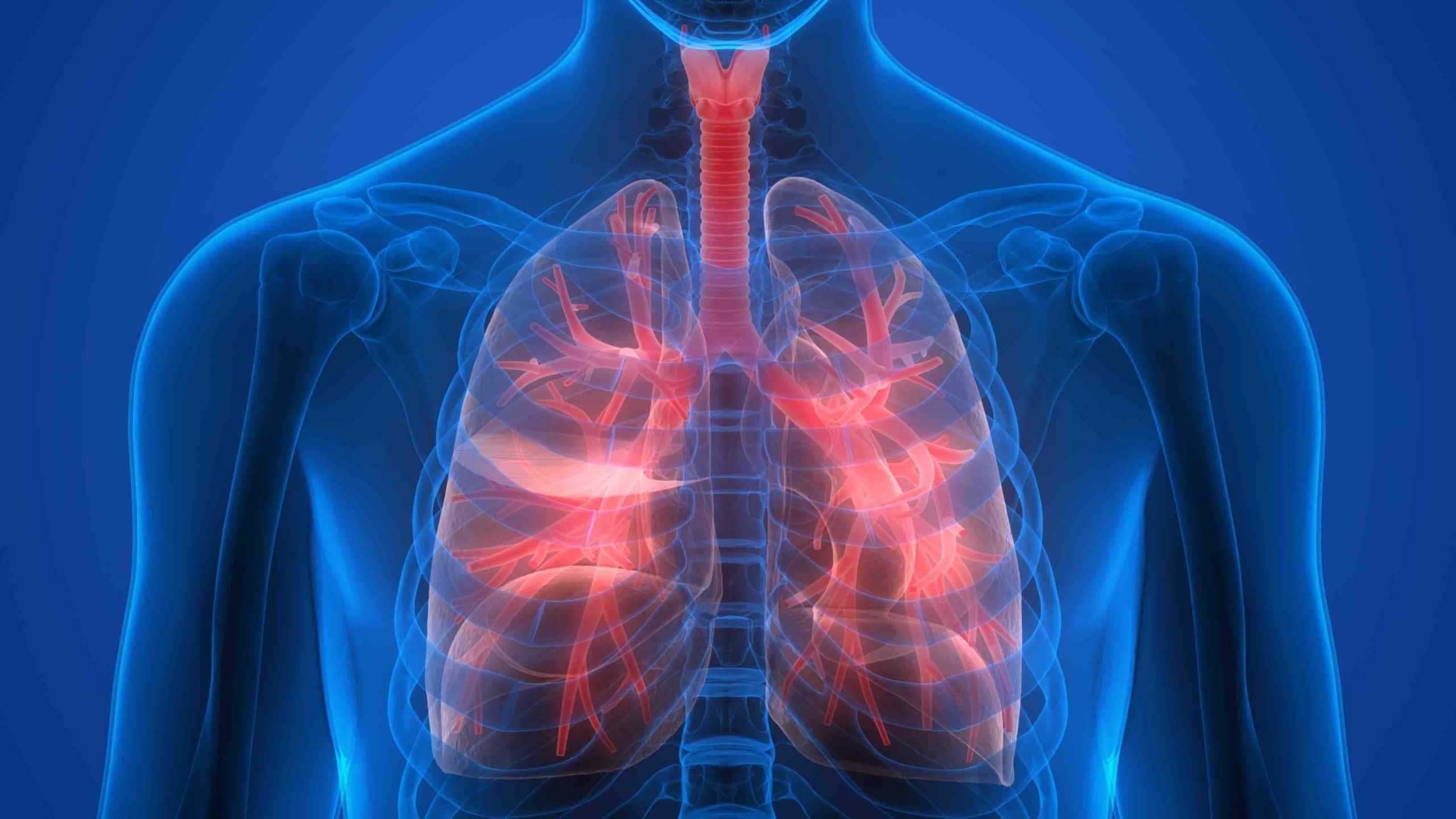 radiographie poumon