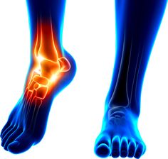 orthopédie pied